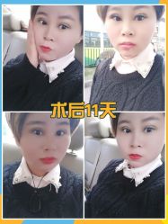 -广东韩妃整形外科医院