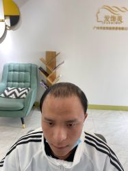 -发饰美男士增发补发假发定制店