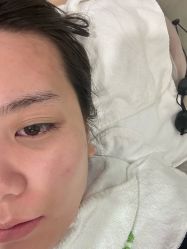 -塑青春&伊肤泉祛痘皮肤管理