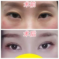 -素美医疗美容·西南眼鼻整形·修复基地