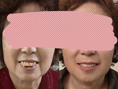 -合众齿科高难度矫正·种植·儿牙中心(望京总院)
