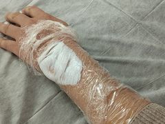 -杭州仁易堂中医康复医院疤痕修复
