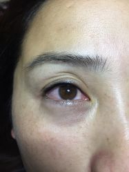 点击看大图 -西施无菌半永久纹绣眉眼影唇轻增发纹发际线