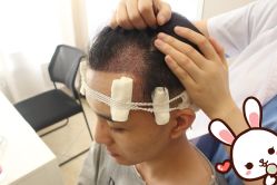 -大麦微针植发丨全国连锁