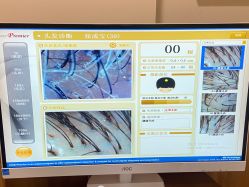 -丝客富脱发养发头皮馆