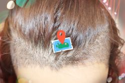 -大麦微针植发全国连锁