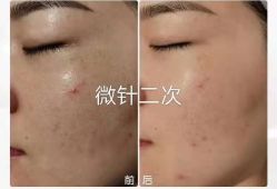 -上海漾颜医疗美容