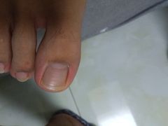 -新甲连锁灰指甲·甲沟炎·鸡眼(黑龙江路店)