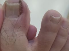 -新甲连锁灰指甲·甲沟炎·鸡眼(黑龙江路店)