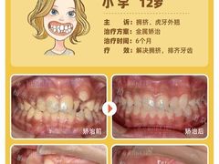 -柏乐口腔(南宁总院)