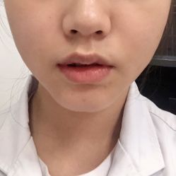 体验后-美莱医学美容医院