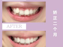 -极光口腔·矫正种植修复(锦江店)