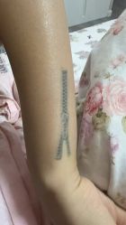 -天道专业洗纹身