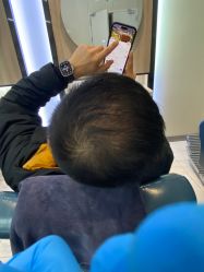 点击看大图 -大麦微针植发丨全国连锁