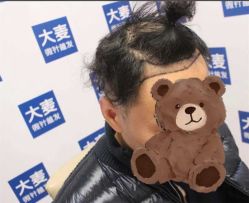 体验前-大麦微针植发丨全国连锁