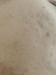 -蕾特恩专业祛痘·皮肤管理