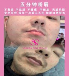 点击看大图 -杨益美学·野生眉半永久纹眉发际线