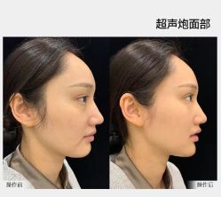 -华美整形美容医院