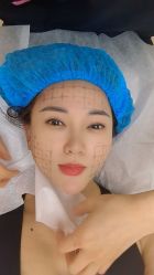 -北京新星靓医美