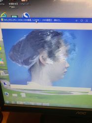 体验前-静港气质医美