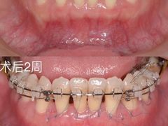 -团圆口腔·种植中心(锦江院区)