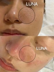 -LUNA皮相美·骨相美高级美感