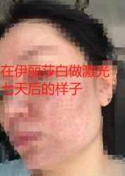 体验后-伊丽莎白医疗美容