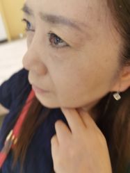 点击看大图 -成都军大整形外科医院