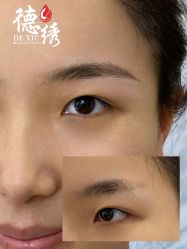 -德绣·机器野生眉发际线·美瞳线半永久