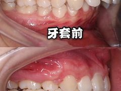 -团圆口腔·种植中心(锦江院区)