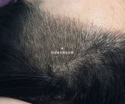 -雍禾植发全国连锁