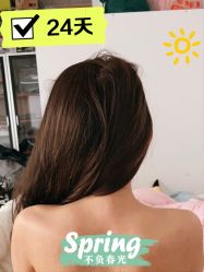 体验后-More摩尔医美の注射线雕光电中心