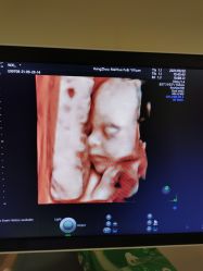 -杭州贝瑞斯美华妇儿医院·早孕·产检·儿科