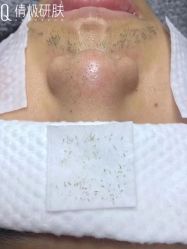 -倩极·精研痘敏肌管理