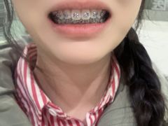 -北京大学口腔医院(第二门诊部)