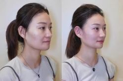 -上海伊莱美医疗美容医院