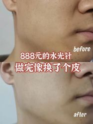 -海峡医疗美容医院