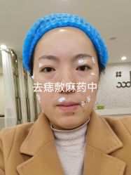 体验前-重庆联合丽格美容医院