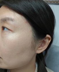 -北京美痣堂古方祛痣斑疣瘊