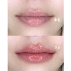 -上海伊莱美医疗美容医院