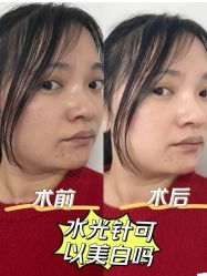 -伊丽莎白医疗美容