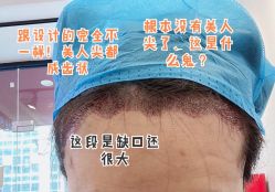点击看大图 -新生植发·植养护一体