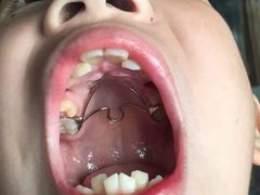 -Dr.Z dental仁康种植矫正中心