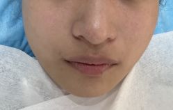 -杭州米兰柏羽医疗美容医院