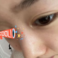 体验后-重庆联合丽格第五医疗美容医院