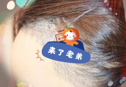 -大麦微针植发全国连锁