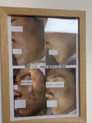 -美肤盾祛痘·问题肌头疗管理中心