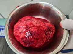 -复旦大学附属华山医院(总院)