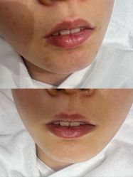 -康美贞·痘肌养护管理中心