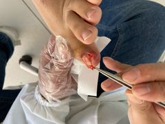 -新甲连锁灰指甲·甲沟炎·鸡眼(黑龙江路店)